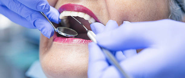 Best Emergency Broken Tooth Repair in Rome City, IN